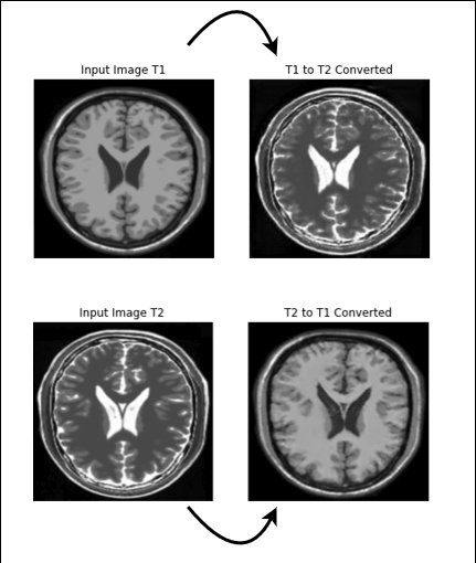 Side-by-side T1 and T2 weighted brain MRI slices produced by the model